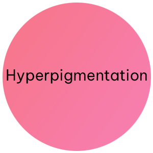 Hyperpigmentation